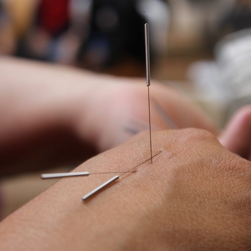 knee with medical tape